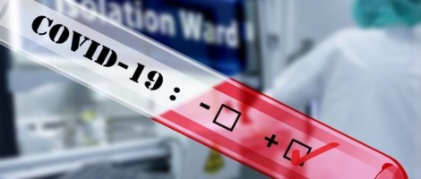 Autoridad sanitaria confirma dos casos de contagio en empresa contratista SIT y descarta vínculo con caso de trabajador de CAP Acero